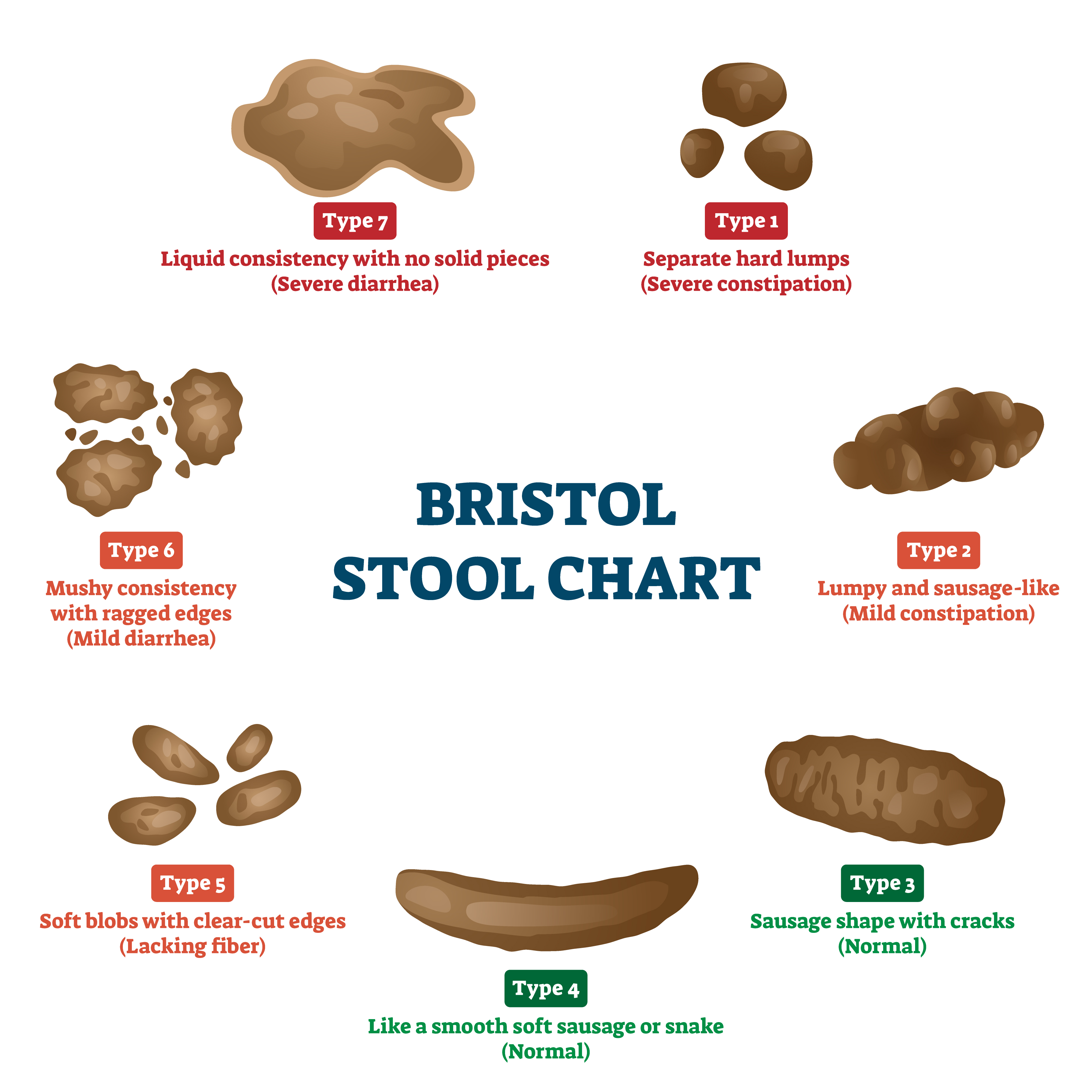 Irritable Bowel Movement Bristol Stool Chart Methodist Health System