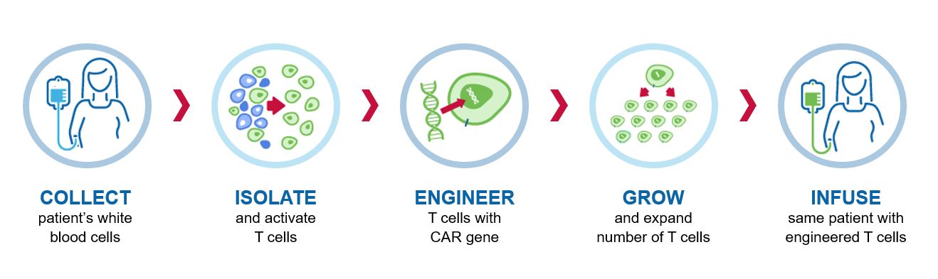 CAR T cell process graphic