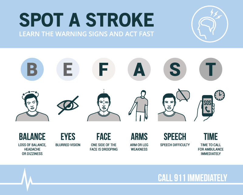 Spot a Stroke: BE FAST
