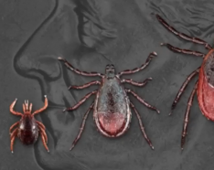 Ticks, KMTV story on Lyme disease
