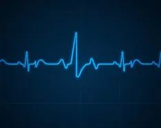 Echocardiography photo