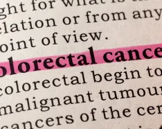 Image for post: The Importance of Colon Cancer Screening 