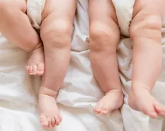 Image for post: Twins: Are They Identical or Fraternal? And Why That's No Question to Roll Your Eyes At