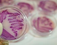 Image for post: Health Alert: Local E. coli Case Linked to Romaine Lettuce Warnings 