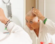 Image for post: Caring for Your Scalp During Chemo Hair Loss
