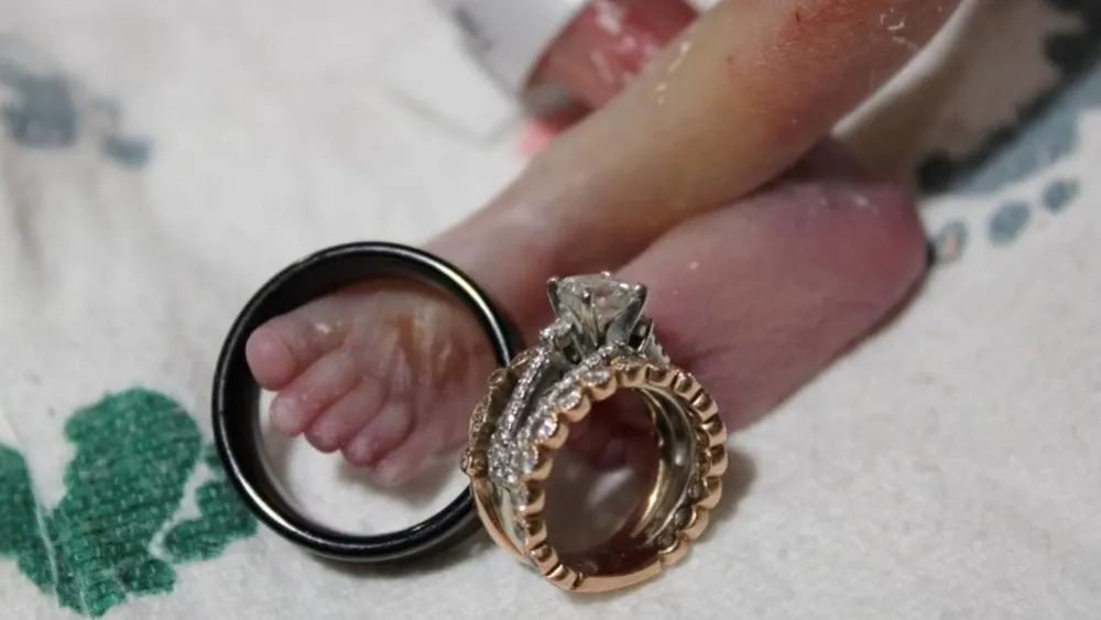 ‘Part of the Grieving Process’: Methodist Women’s Hospital Staff Provides Couple Compassionate Care and Keepsake Photos 