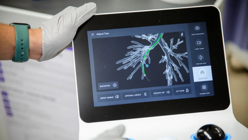 Ion by Intuitive - robotic-assisted surgical system for lung biopsies