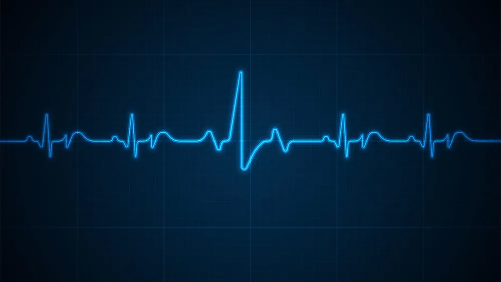 Echocardiography photo