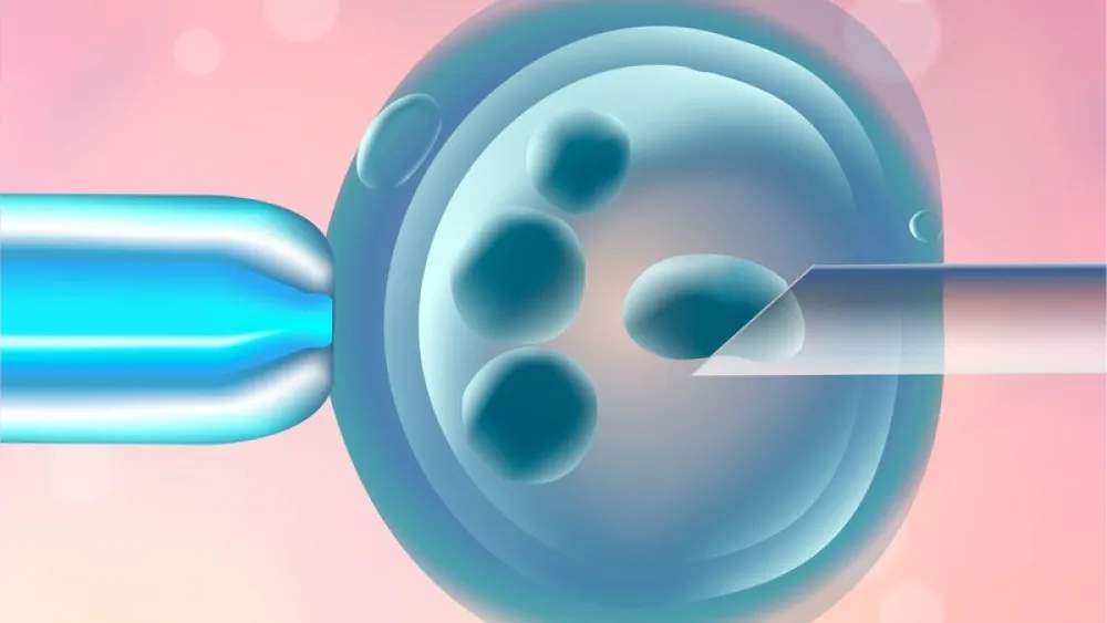 Image for post: The Pros and Cons of Becoming an Egg Donor