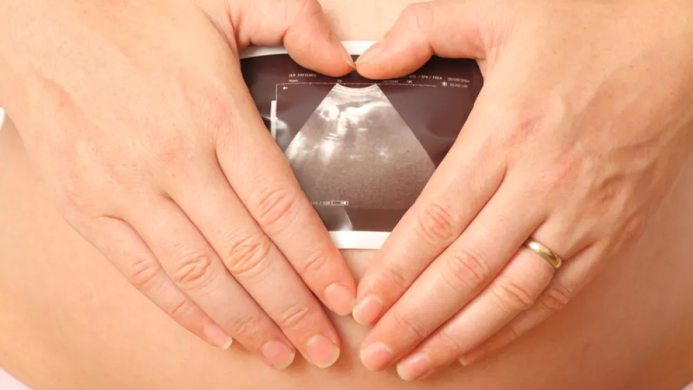 Image for post: Congenital Heart Defects: Making Sense of Little Broken Hearts