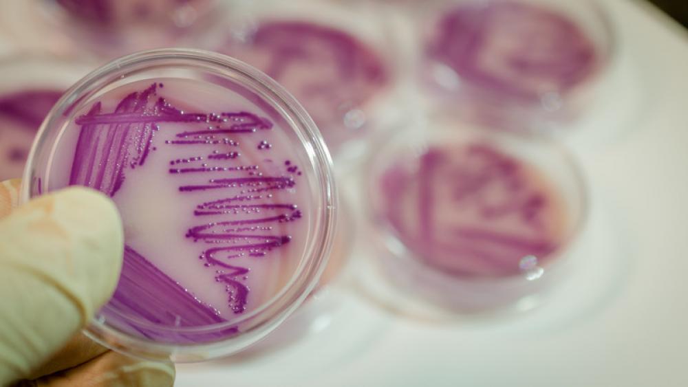 Image for post: Health Alert: Local E. coli Case Linked to Romaine Lettuce Warnings 