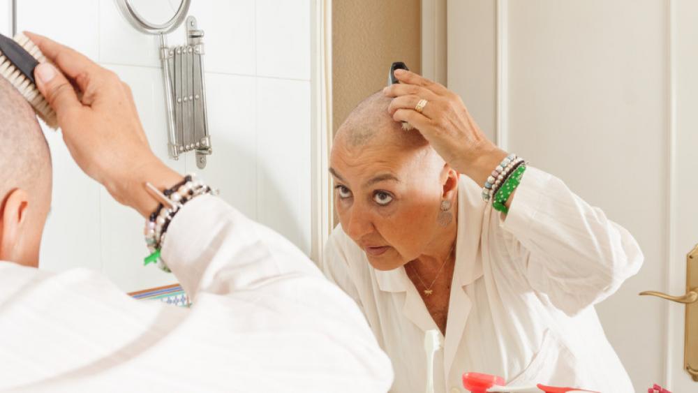 Image for post: Caring for Your Scalp During Chemo Hair Loss