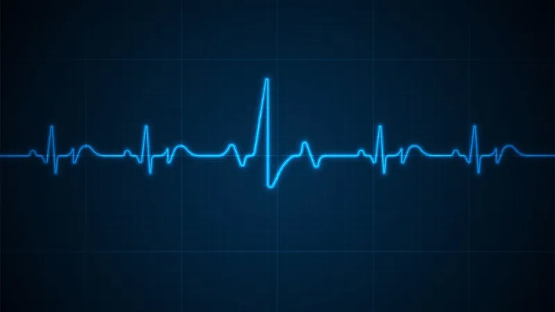 Echocardiography photo